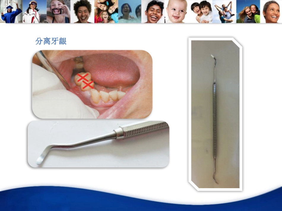 口腔培训032.EXT拔牙四手操作_第13页
