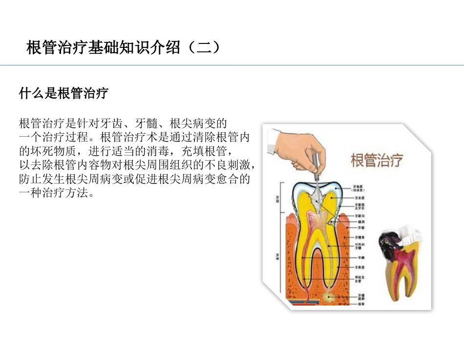 口腔培训037.RCT根管治疗_第3页