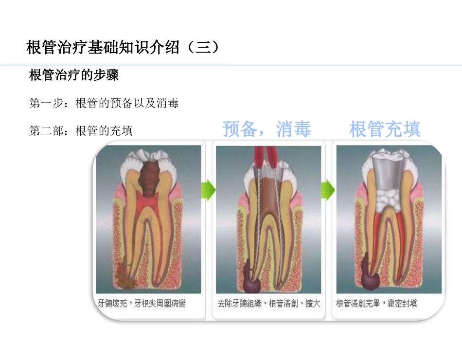 口腔培训037.RCT根管治疗_第4页