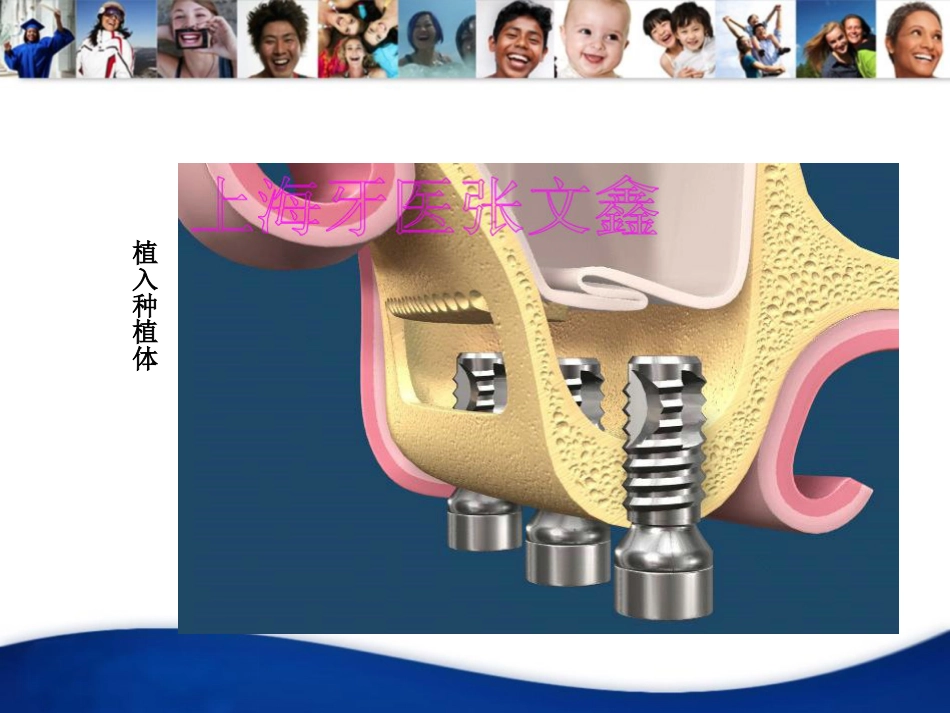 口腔培训041.上颌窦外提升手术_第8页