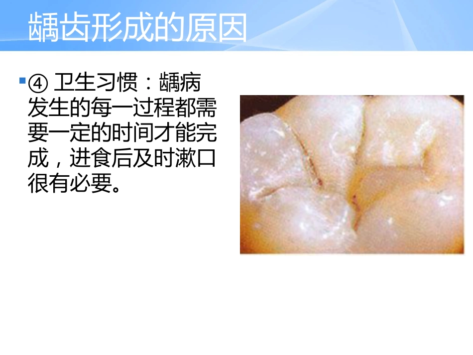 口腔培训042.中老年人常见口腔问题_第13页