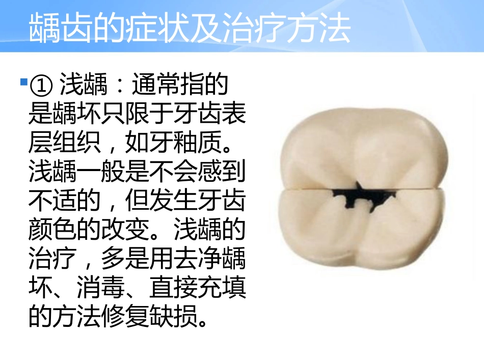 口腔培训042.中老年人常见口腔问题_第14页