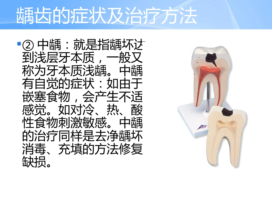 口腔培训042.中老年人常见口腔问题_第15页