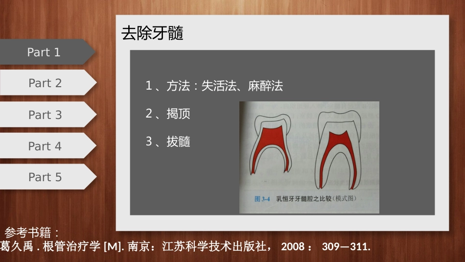 口腔培训043.乳恒牙根管治疗的鉴别_第3页