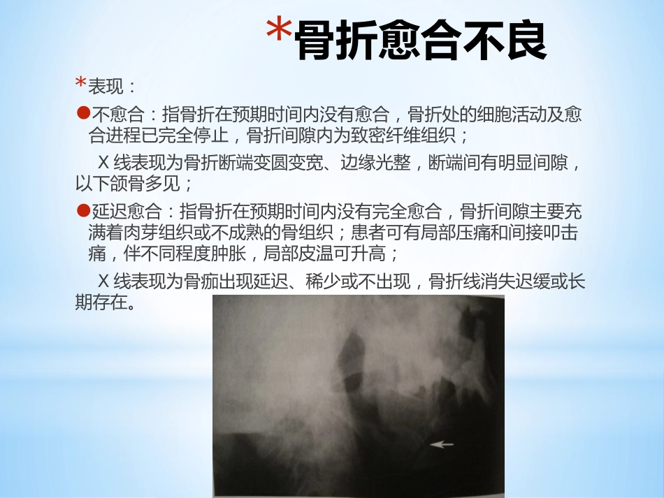 口腔培训046.儿童髁突的骨折愈合_第4页