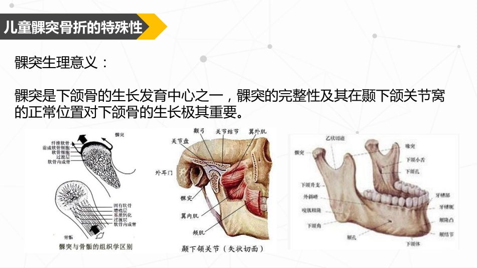 口腔培训047.儿童髁突骨折处理_第5页