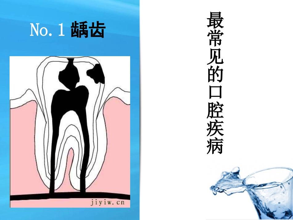 口腔培训050.口腔保健知识讲座-课件_第13页