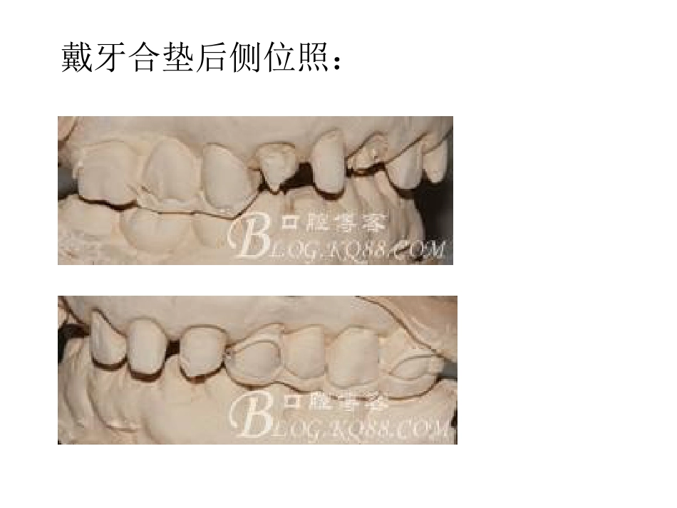 口腔培训051.口腔修复学中的咬合重建问题_第11页