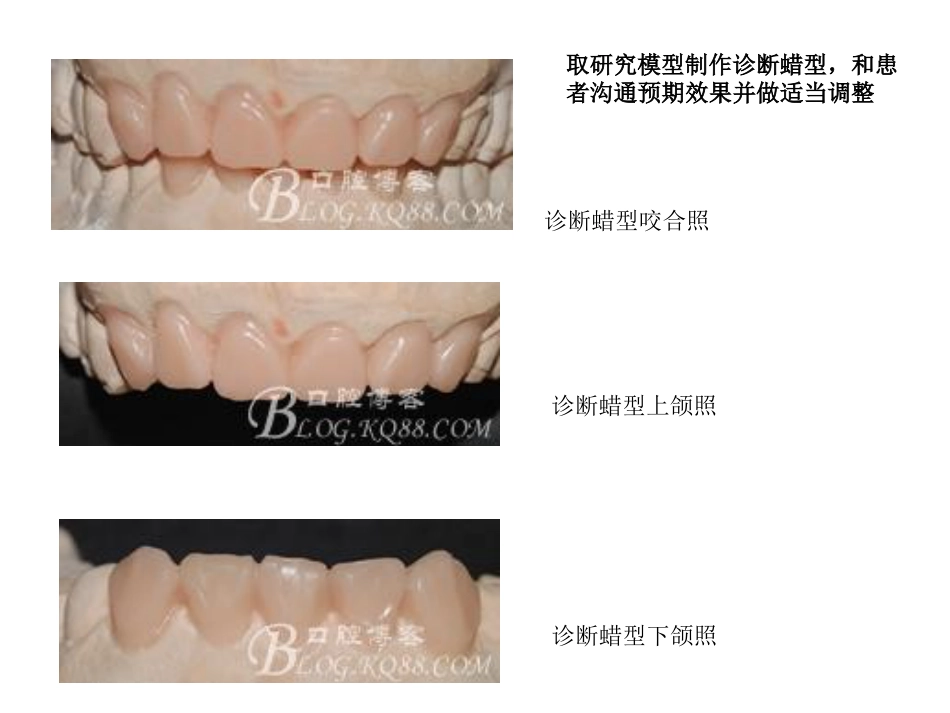 口腔培训051.口腔修复学中的咬合重建问题_第13页