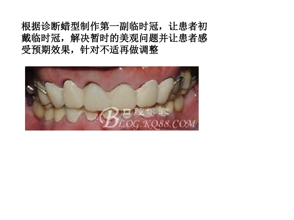 口腔培训051.口腔修复学中的咬合重建问题_第14页