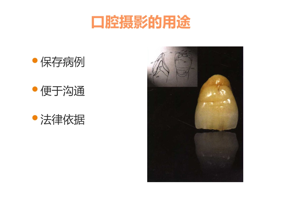 口腔培训053.口腔基础摄影_第2页