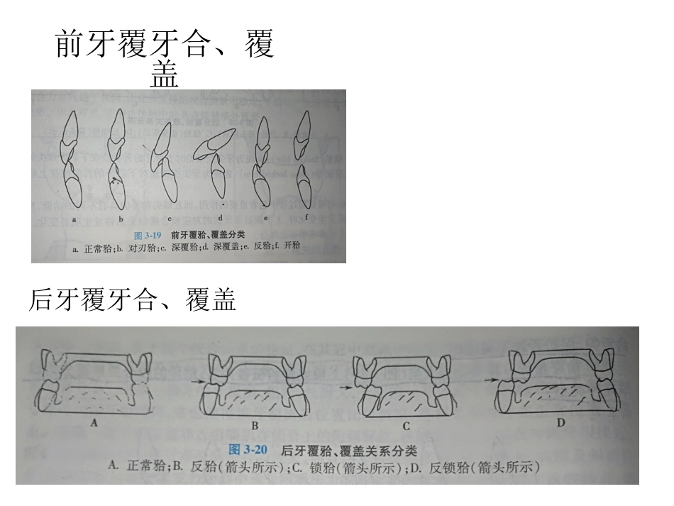口腔培训057.咬合接触_第10页