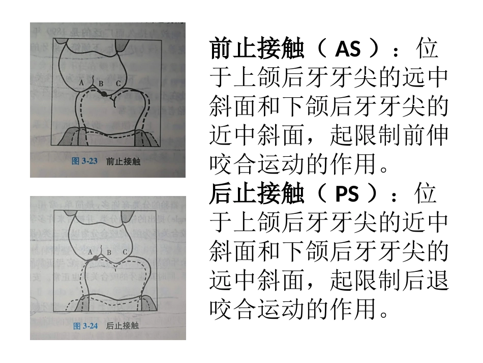 口腔培训057.咬合接触_第13页