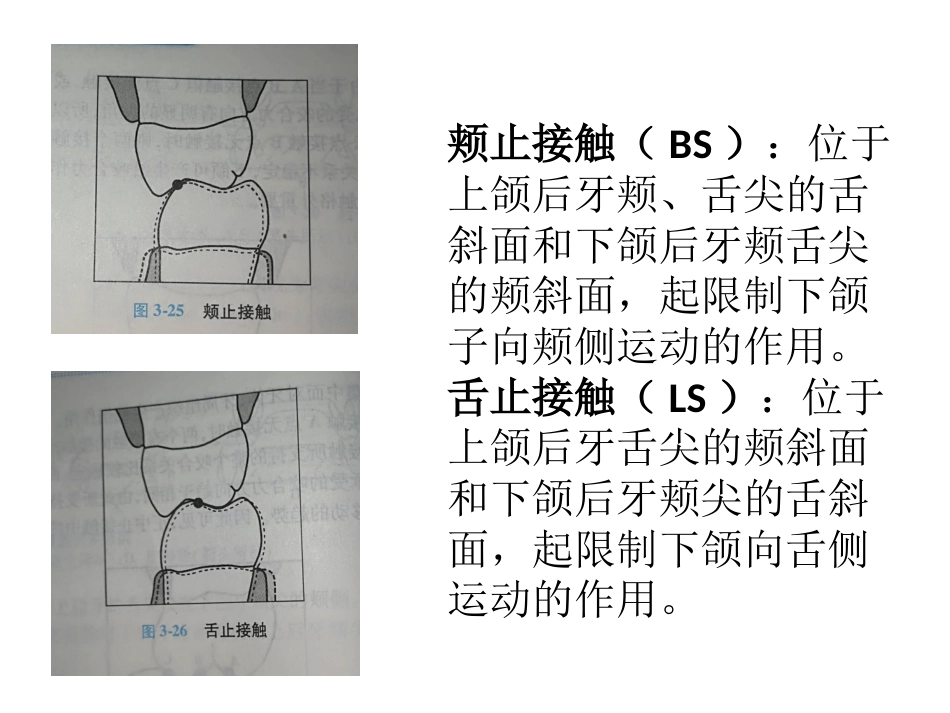 口腔培训057.咬合接触_第14页