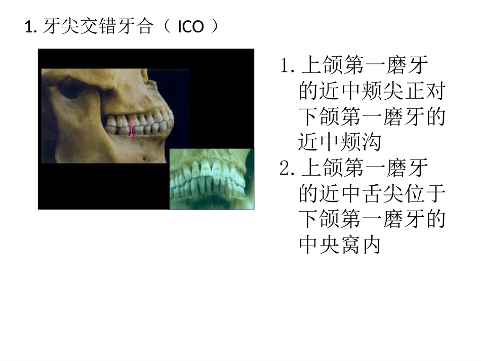 口腔培训057.咬合接触_第6页