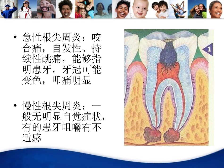 口腔培训058.四手操作-根管治疗(1)_第4页