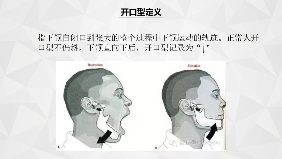 口腔培训062.开口型异常的原因_第3页