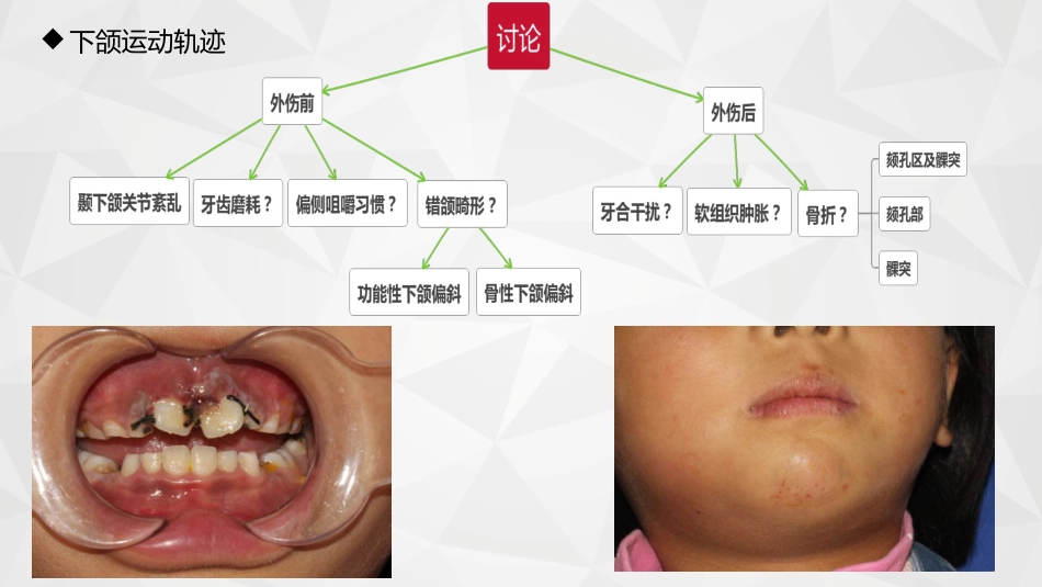 口腔培训062.开口型异常的原因_第8页