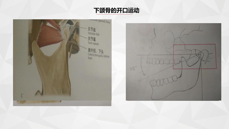 口腔培训063.张口受限_第5页