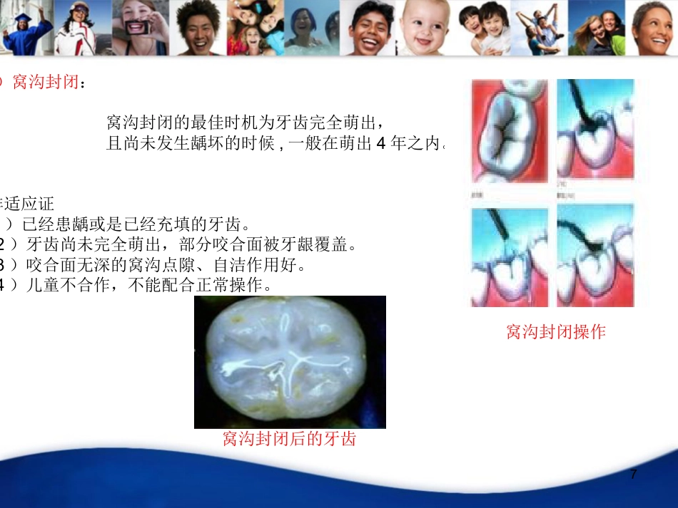 口腔培训070.儿童口腔知识宣教资料PPT_第7页