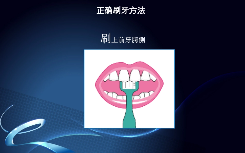口腔培训076.新种植牙围手术期及术后口腔保健_第11页