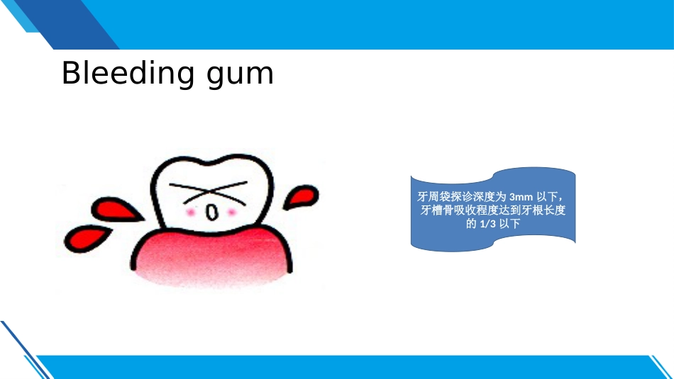 口腔培训084.洁牙沟通2_第9页