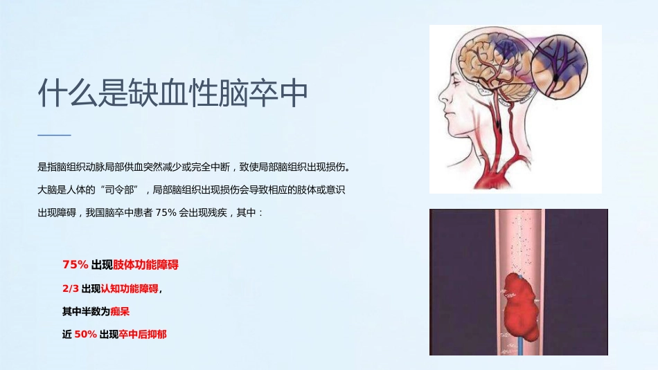医疗预防高血压心脑血管疾病健康讲座PPT_第14页