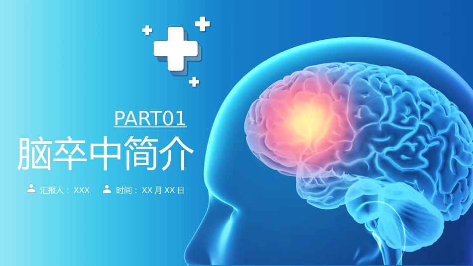 脑卒中康复治疗脑中风医疗报告PPT_第4页