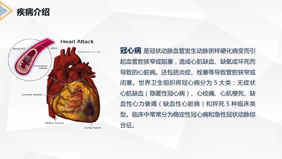 冠心病病人的护理查房_第4页