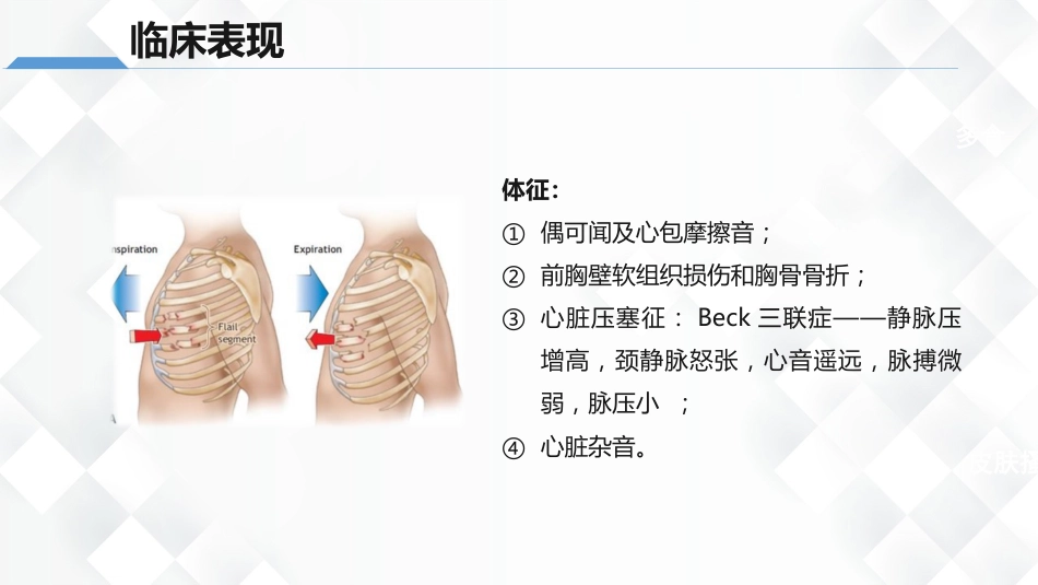 心脏损伤的护理业务教学课件_第8页