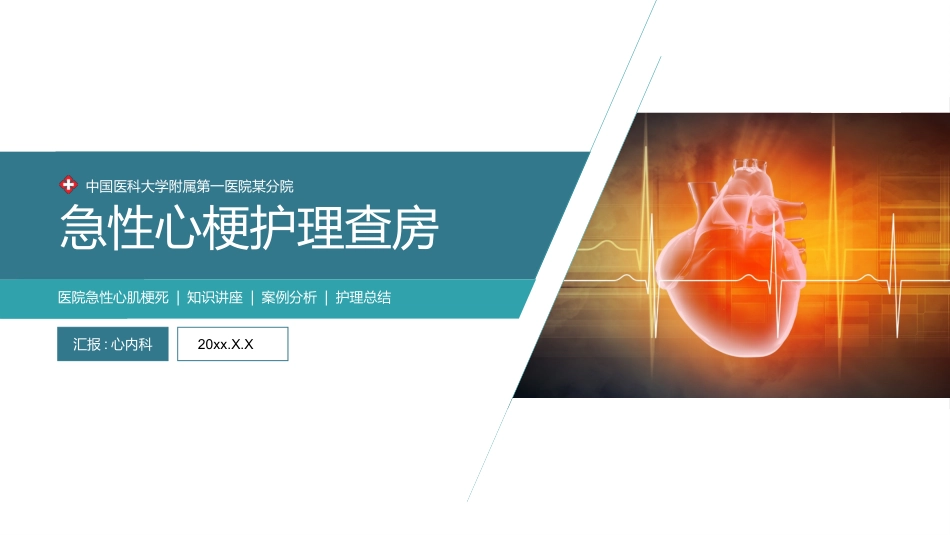 心梗心脏病护理查房病例讨论PPT_第1页