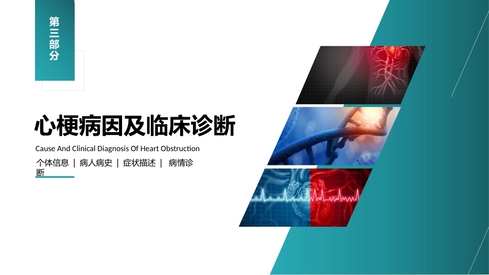 心梗心脏病护理查房病例讨论PPT_第13页