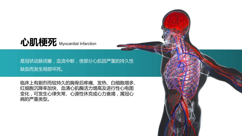 心梗心脏病护理查房病例讨论PPT_第14页
