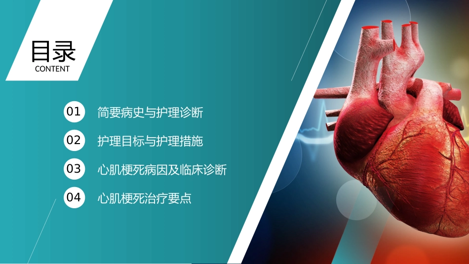 心梗心脏病护理查房病例讨论PPT_第2页
