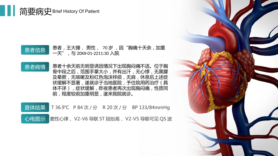 心梗心脏病护理查房病例讨论PPT_第4页