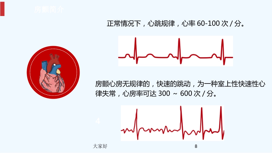 房颤健康宣教PPT_第8页