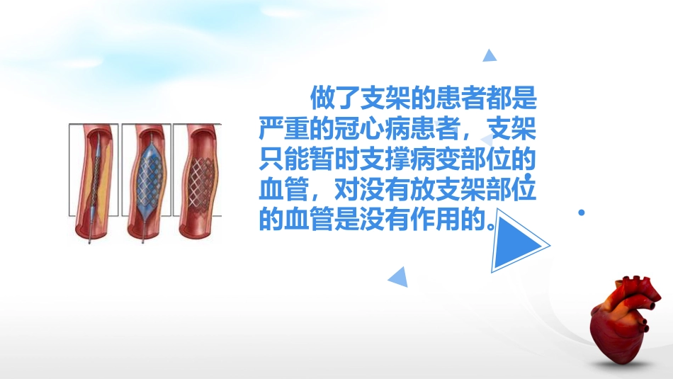 冠脉支架后_第5页