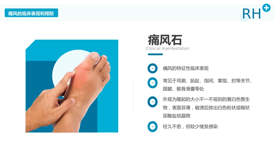 风湿性痛风内科医疗保健医学教程ppt_第12页