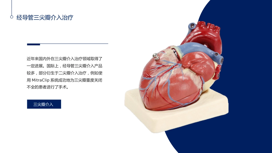 心脏瓣膜病介入治疗的现状与进展_第13页