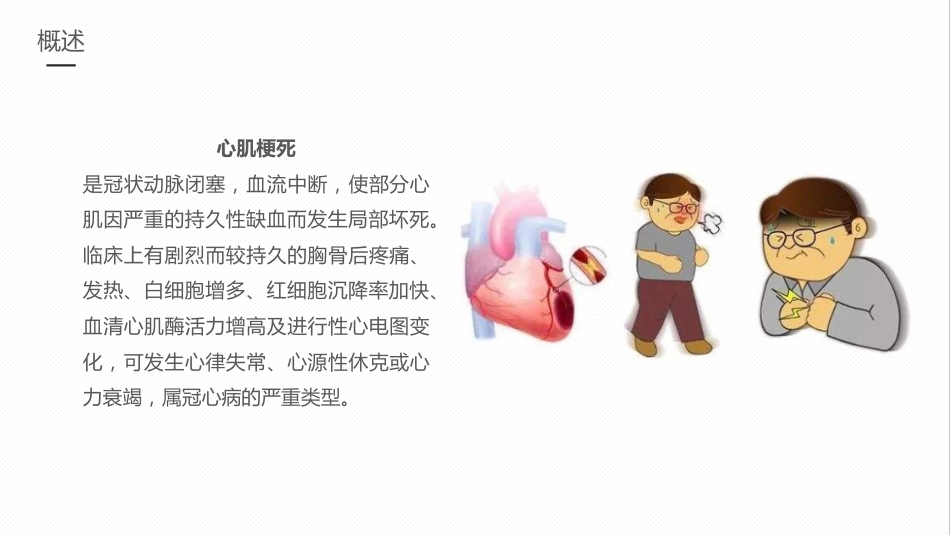 急性心梗的护理业务学习课件_第4页
