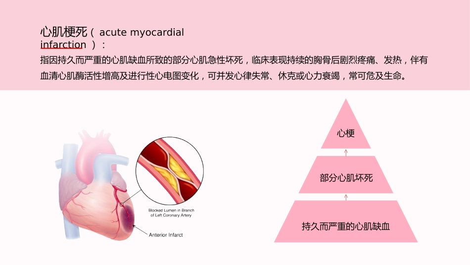急性心梗护理查房完整分析_第4页