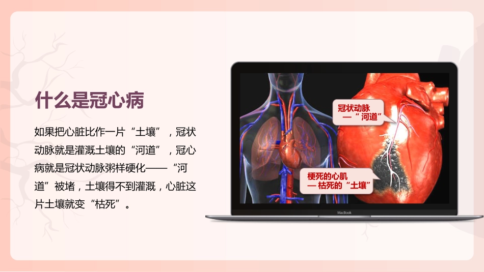 冠心病健康教育PPT_第4页
