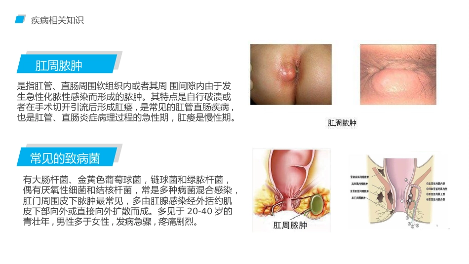 肛肠科护理查房4_第4页