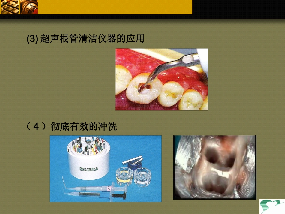 口腔培训103.牙科基本治疗内容介绍_第11页