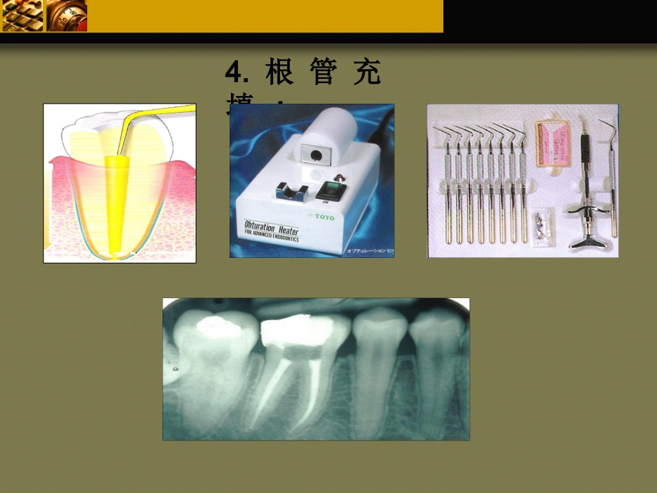 口腔培训103.牙科基本治疗内容介绍_第13页