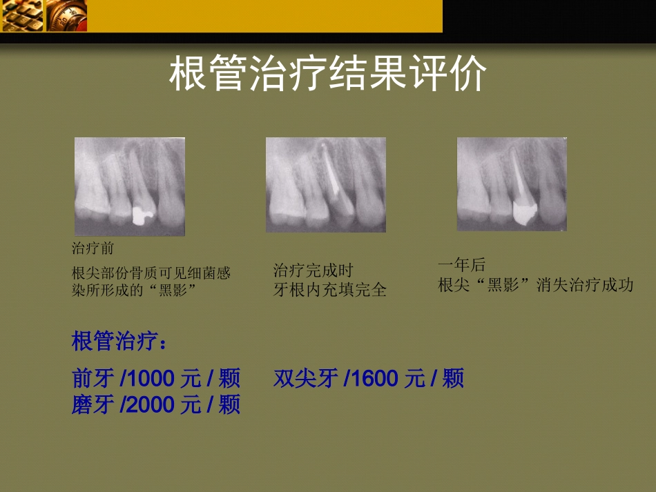 口腔培训103.牙科基本治疗内容介绍_第15页