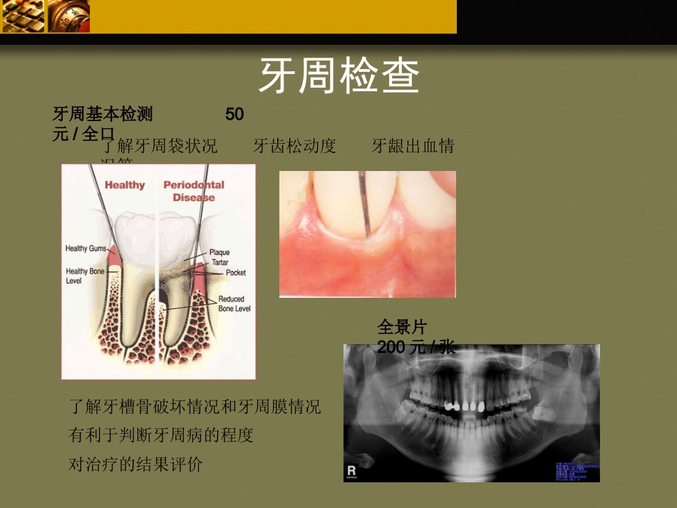 口腔培训103.牙科基本治疗内容介绍_第3页