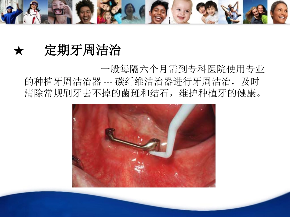 口腔培训108.种植体维护_第5页