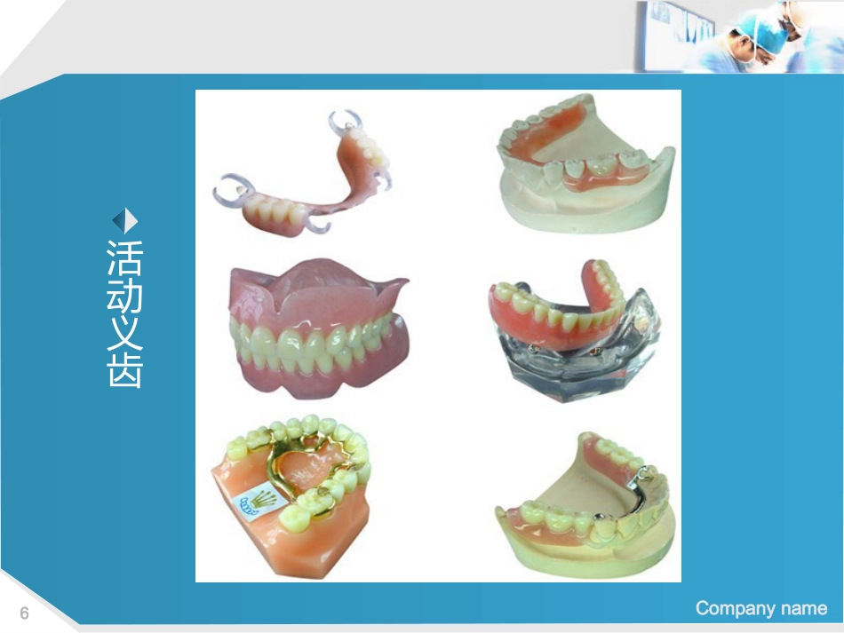 口腔培训112.种植牙讲座ppt演讲稿_第6页