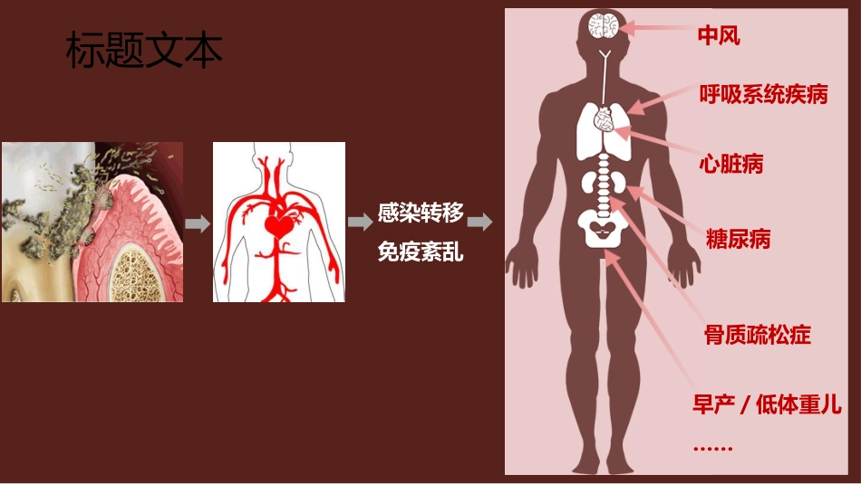 口腔培训115.为什么要洁牙（医生版）_第10页